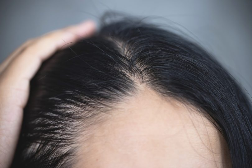 young-woman-shows-her-gray-hair-roots