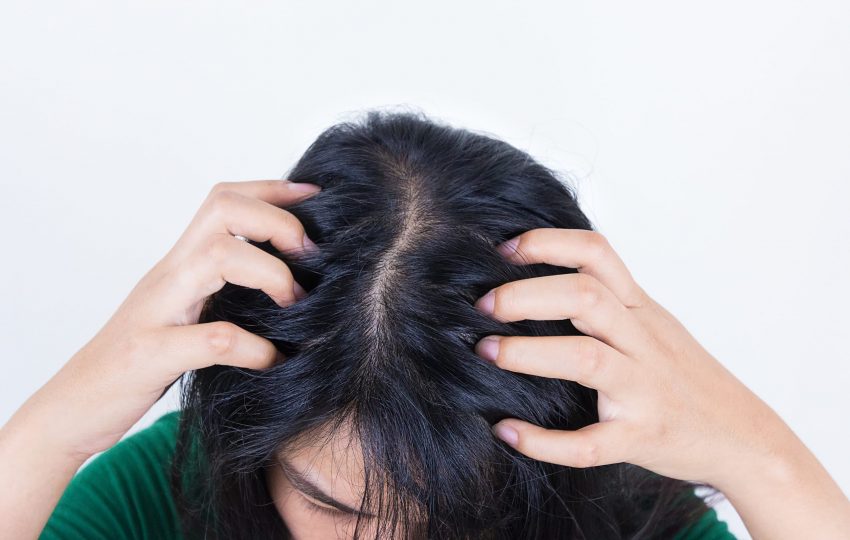woman-suffering-from-itching-her-head-itching-scalp