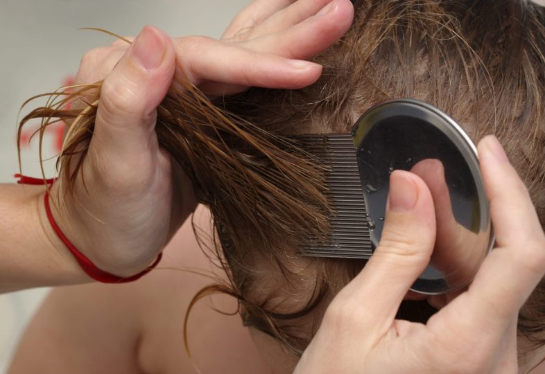 head-lice-treatment-for-bug-removal