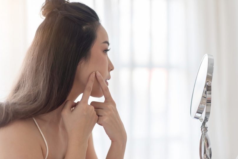 worried-young-girl-of-her-acne