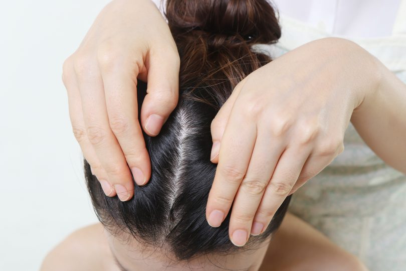 dermatologist-examining-patients-scalp