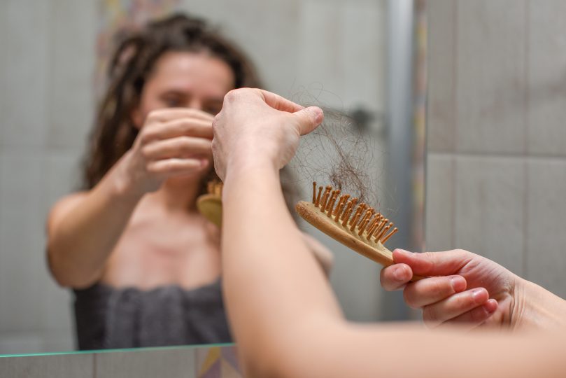 hair-loss